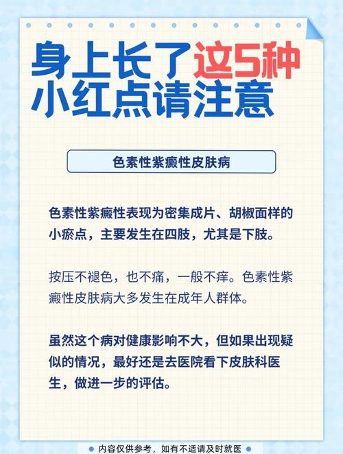 紫癜应该注意什么