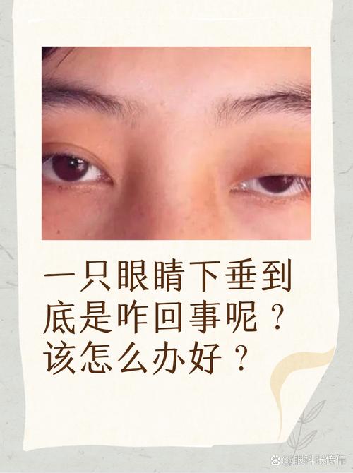 睑读什么
