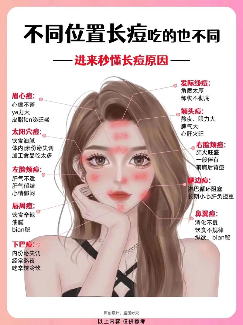 一直长痘痘是什么原因