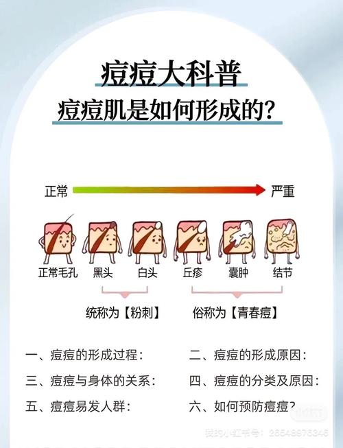 一直长痘痘是什么原因