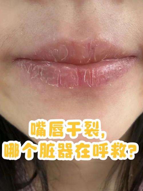 嘴唇裂开是什么原因