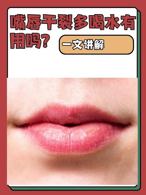 嘴唇裂开是什么原因