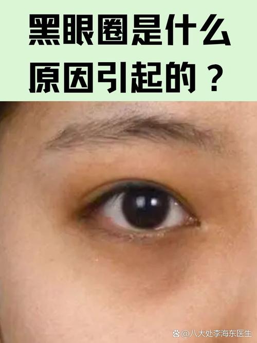 看黑眼圈挂什么科