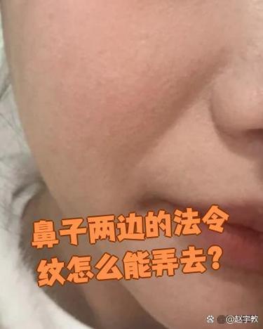 鼻子两边叫什么纹