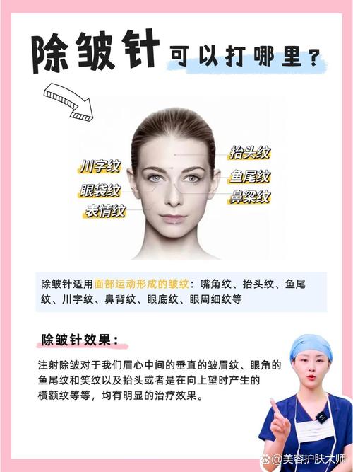 除皱针有什么副作用