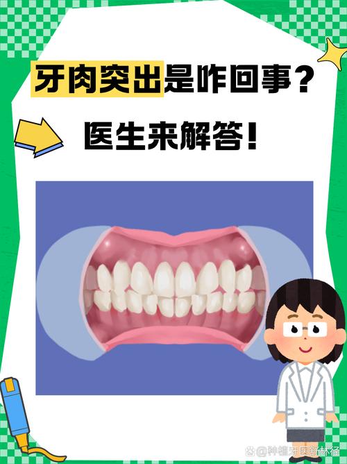 牙龈突出是什么原因