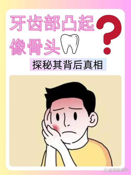 牙龈突出是什么原因
