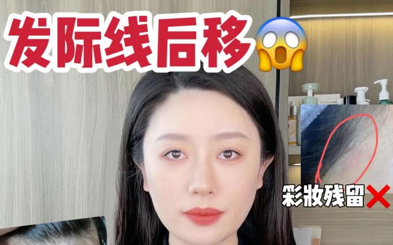 洗面奶碰到发际线会怎么样