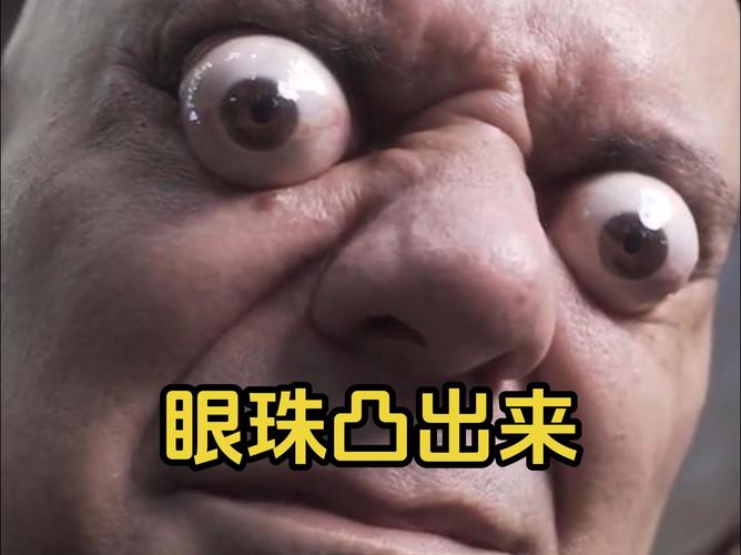 眼珠突出是什么原因