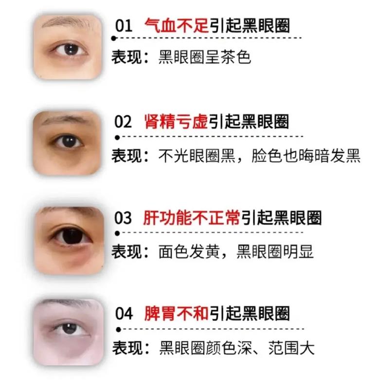 眼圈发黄是什么原因
