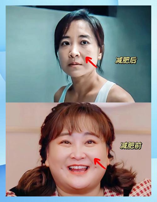 减肥以后脸为什么不瘦