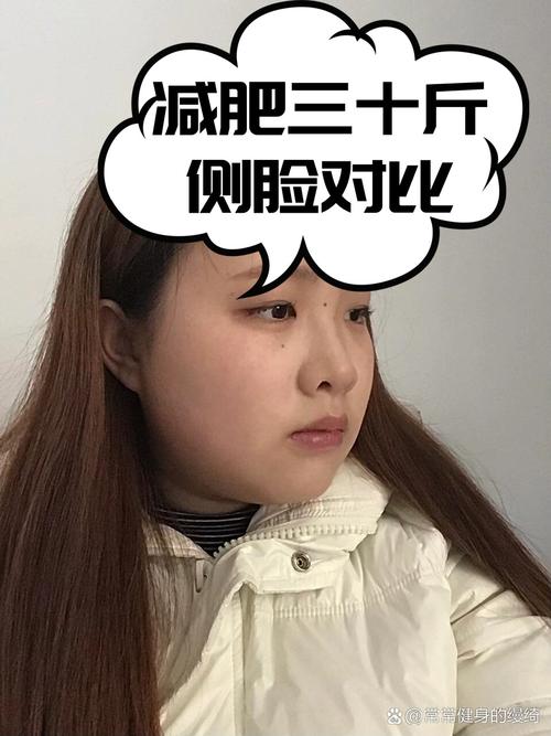 减肥以后脸为什么不瘦