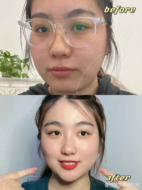 减肥以后脸为什么不瘦
