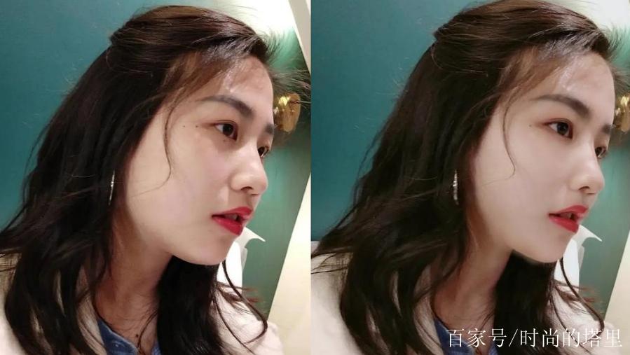 减肥后鼻子有什么变化