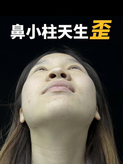 鼻子歪什么原因