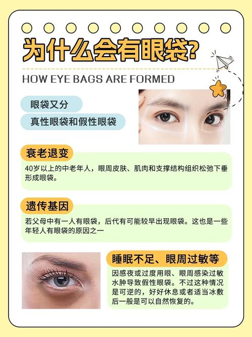 为什么会形成眼袋