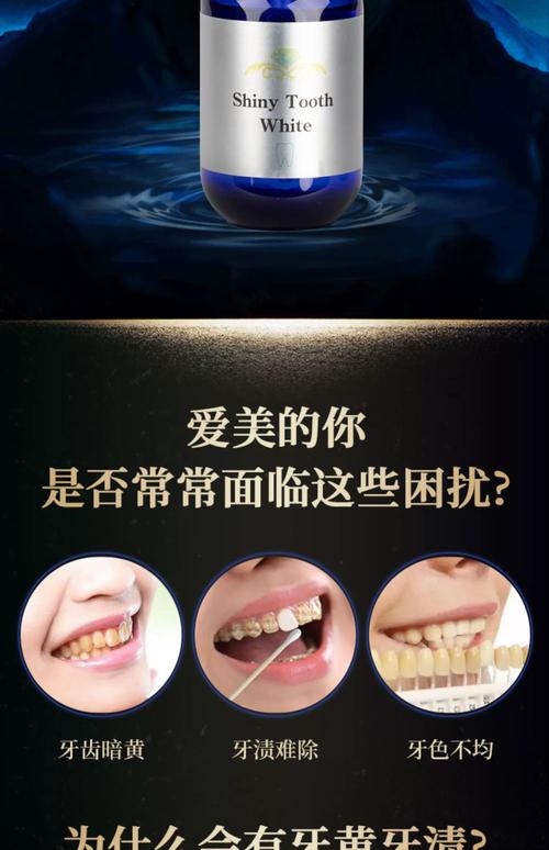 牙齿美白用什么好