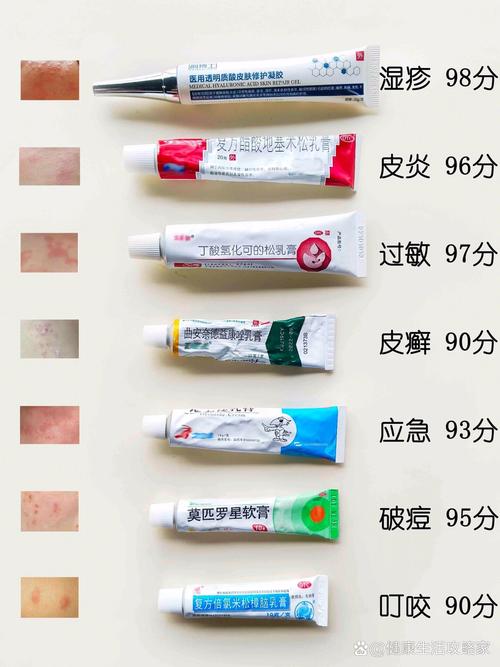 皮肤湿疹擦什么药膏