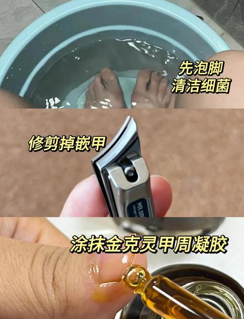 甲沟炎有什么危害