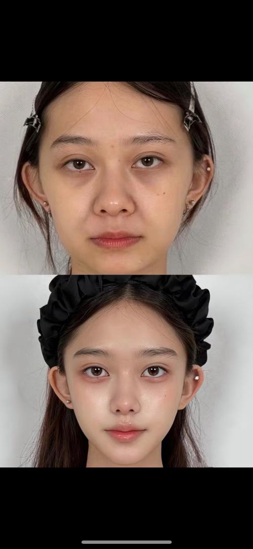 什么叫微整