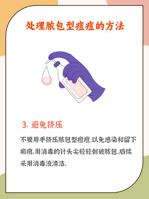 用洗面奶后怎么护理