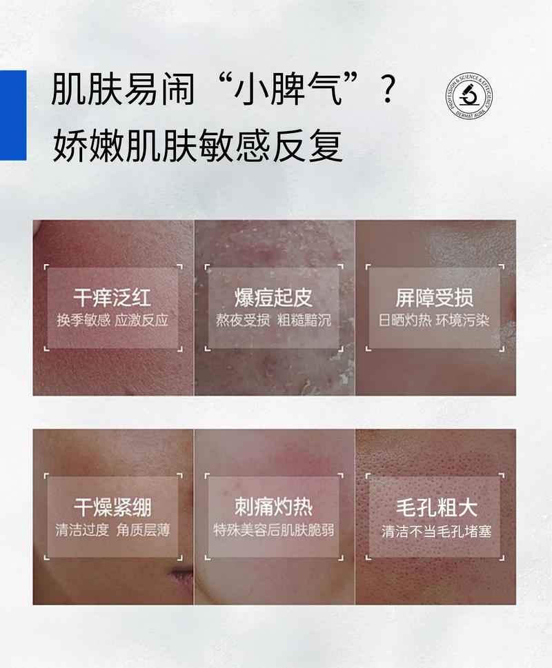 什么叫敏感肌肤