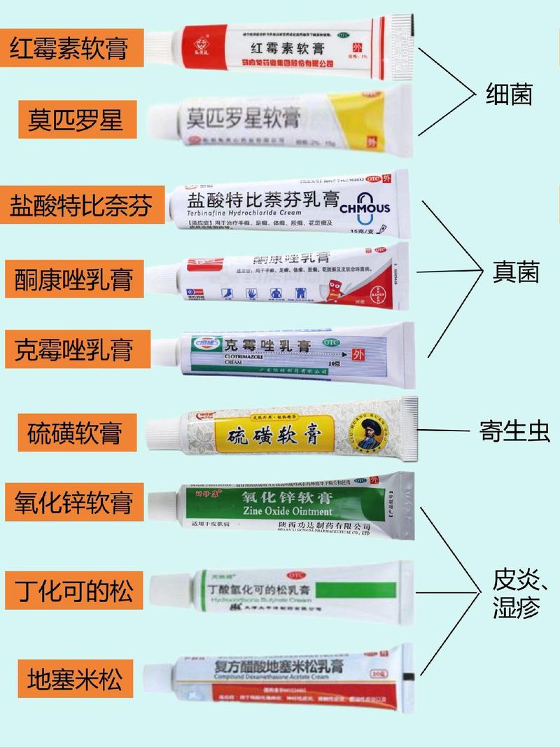 神经性皮炎擦什么药