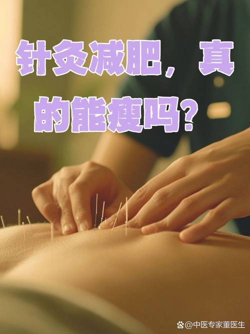 针灸减肥配合什么运动减肥快