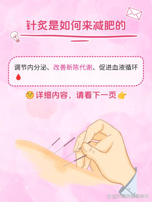 针灸减肥配合什么运动减肥快