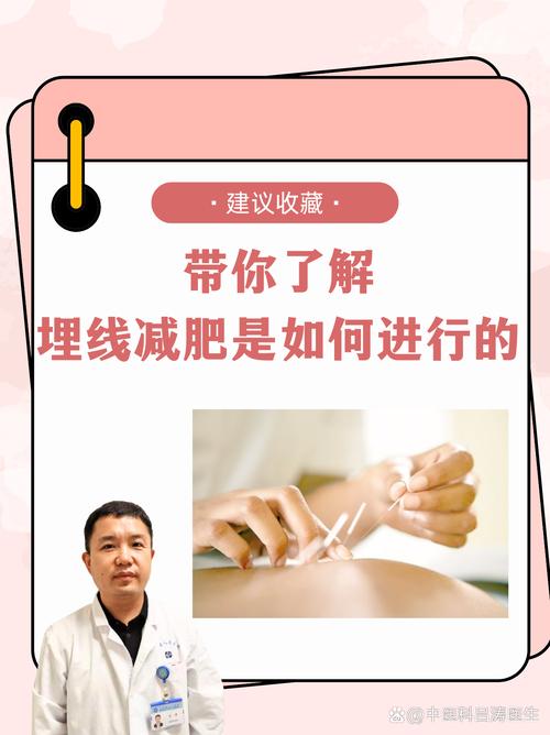 中医埋线减肥是什么线