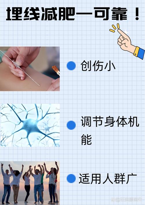 中医埋线减肥是什么线