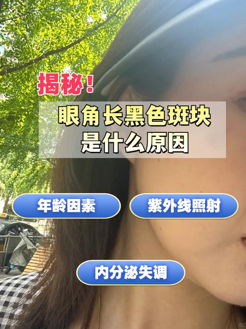 眼皮长斑是什么原因