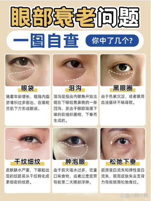眼窝深是什么原因