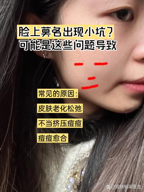 为什么脸上有小坑