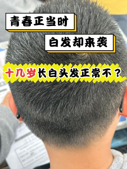 白头发跟什么有关