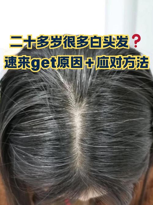 白头发跟什么有关