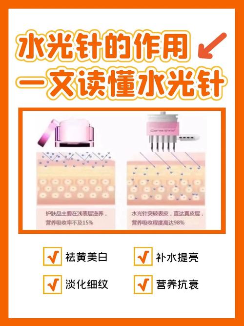水光针起什么作用