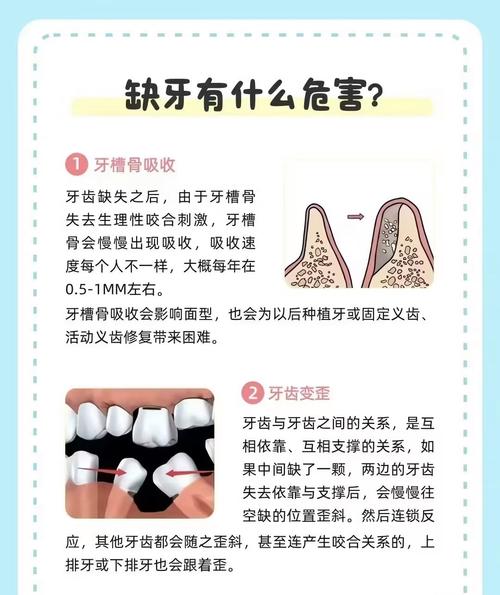 牙齿不好是缺什么