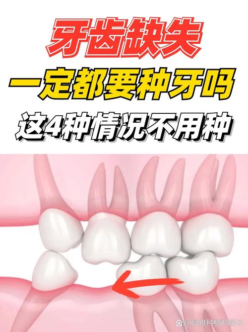 牙齿不好是缺什么