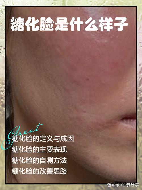 什么是皮肤糖化
