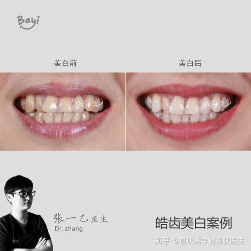 皓齿对什么