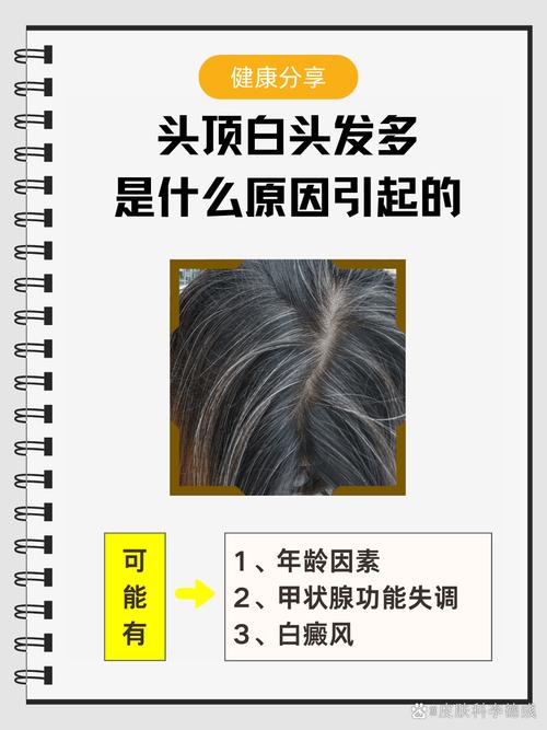 人为什么会有白头发