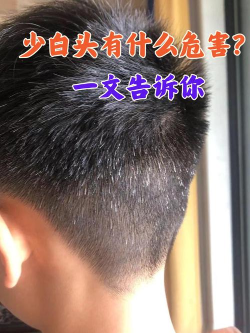 人为什么会有白头发