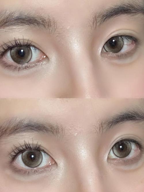 睫毛短是什么原因