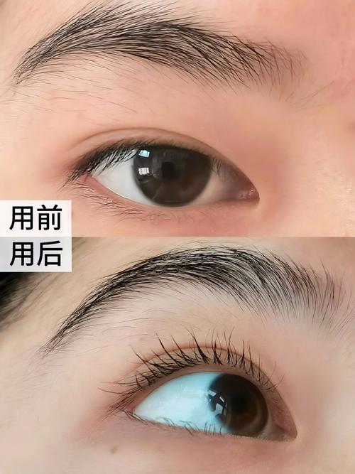 睫毛短是什么原因