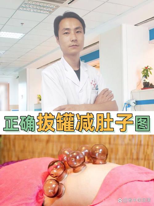 拔火罐拔什么位置减肥