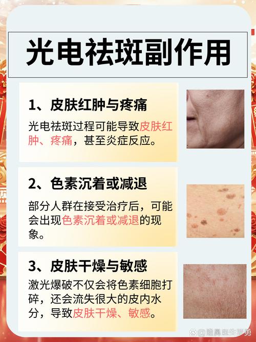 什么祛斑有效果