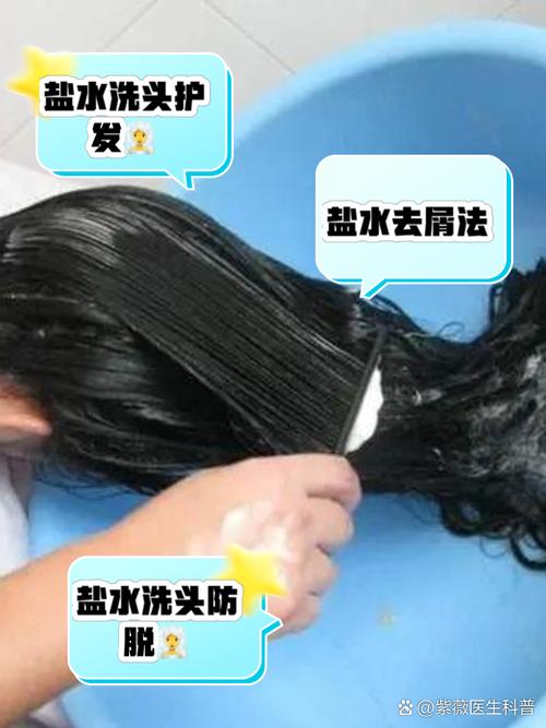 洗头加盐有什么好处