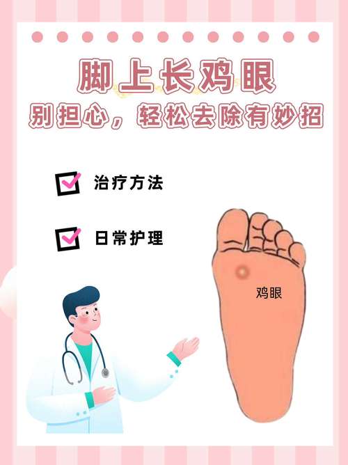 脚趾为什么会长鸡眼