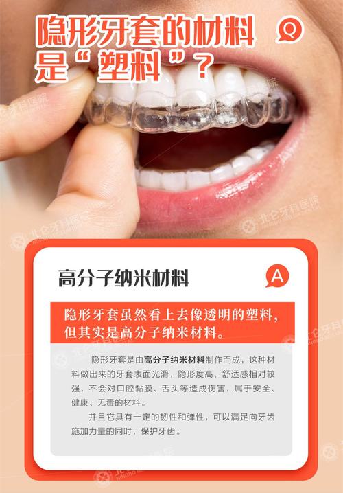 牙套都有什么材质